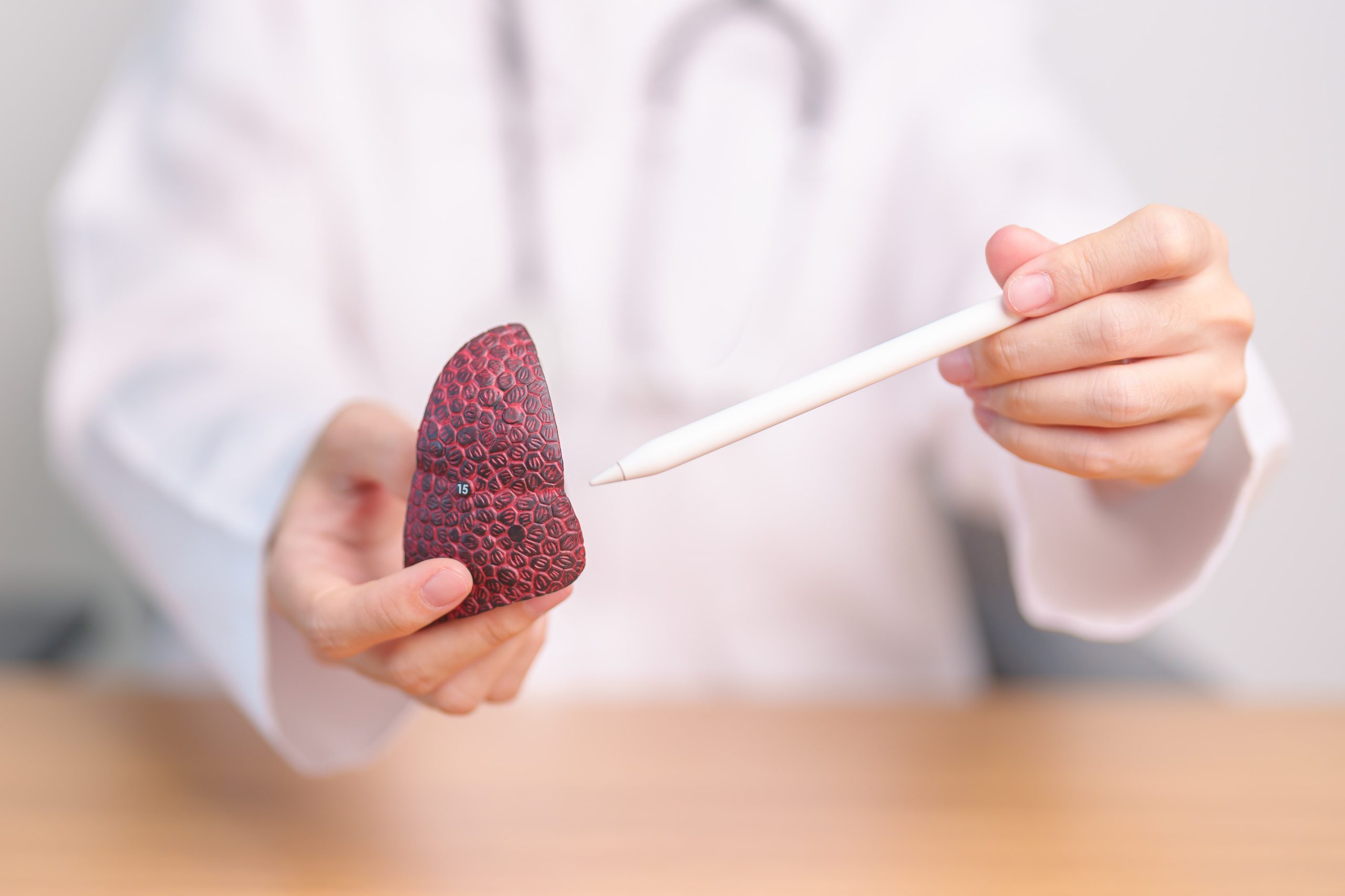 علاج سرطان الكبد