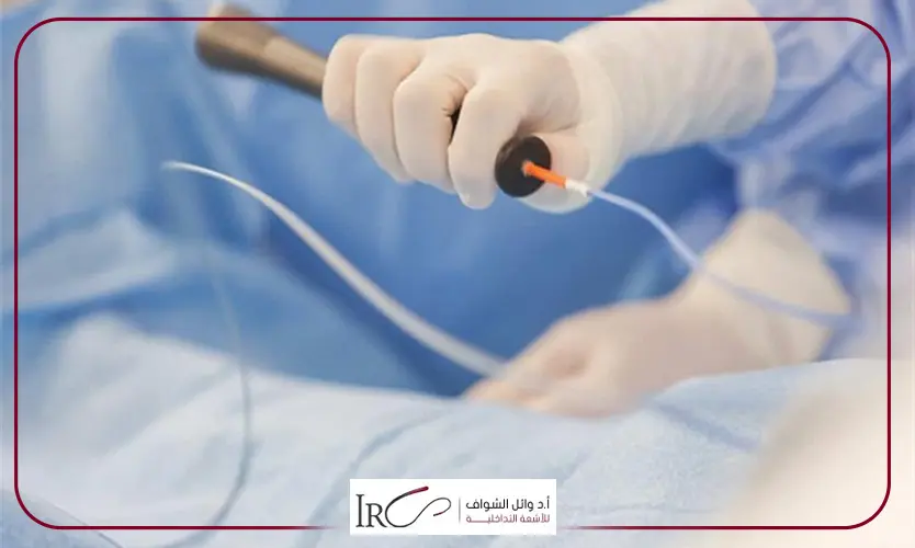 القسطرة العلاجية