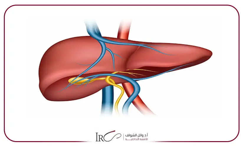 توسيع القنوات المرارية
