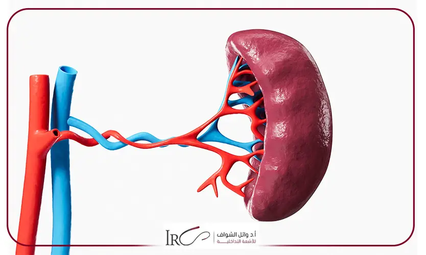 علاج تضخم الطحال